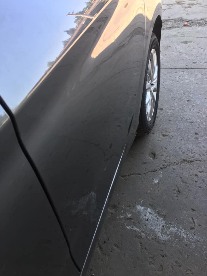 PDR tekniği ile göçük düzeltme sonrası